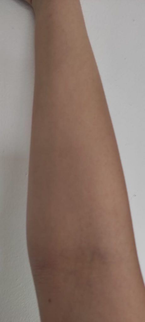 After using the AmeRu Hydrating Body Crème - Picture taken 11/02/2022